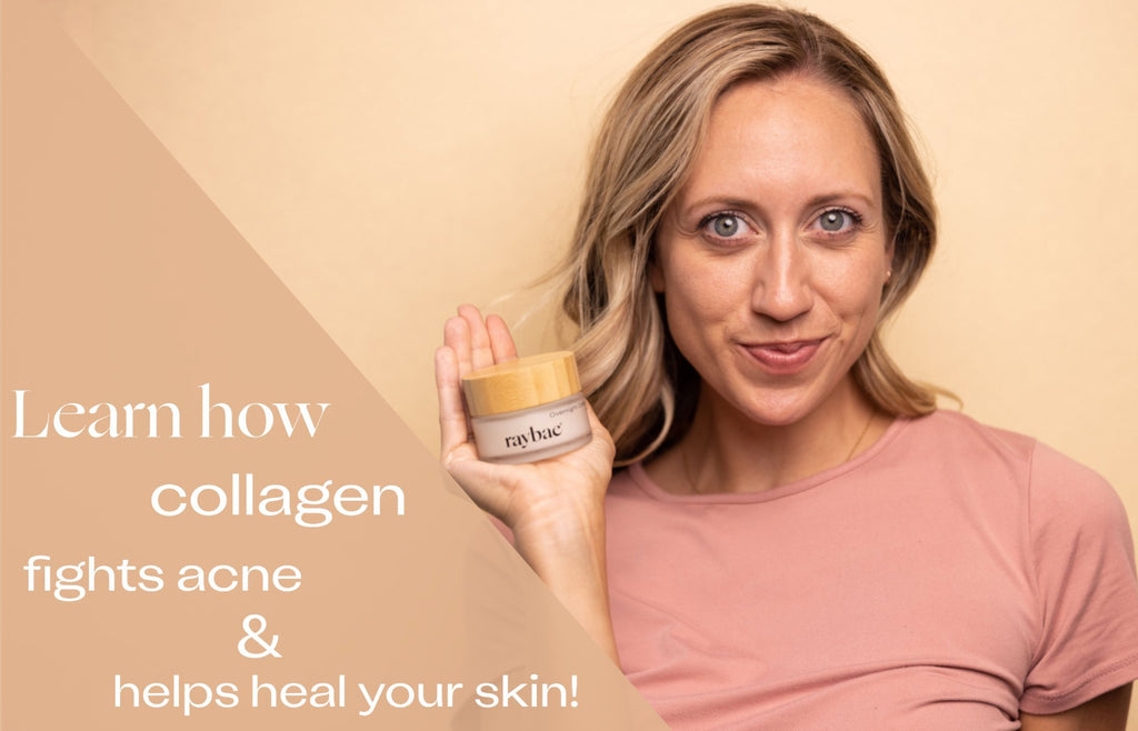 Does Acne have you wanting to stay home? Consider collagen! - raybae