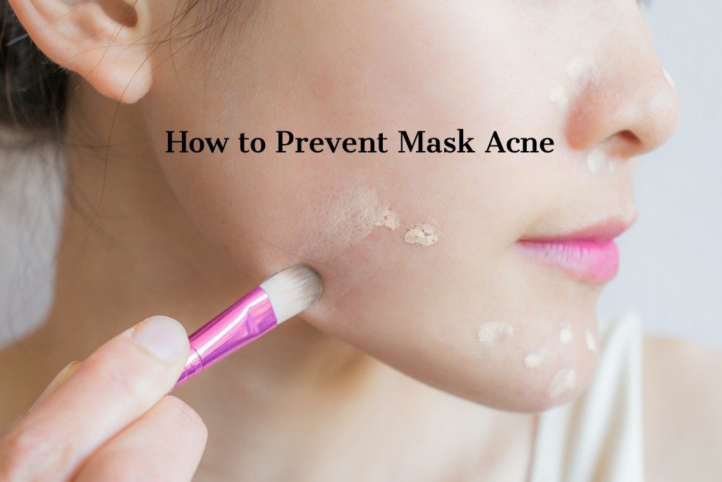 How to Prevent Mask Acne - raybae